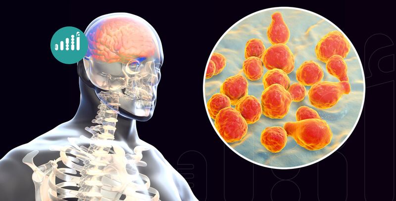 بعد قرار الصحة الذي أُعلِن اليوم: إليك هذه المعلومات الوافية عن الحمى الشوكية