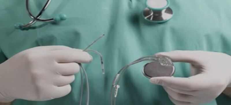 اختصاصي يوضح حول استخدام جهاز منظم دقات القلب للأطفال