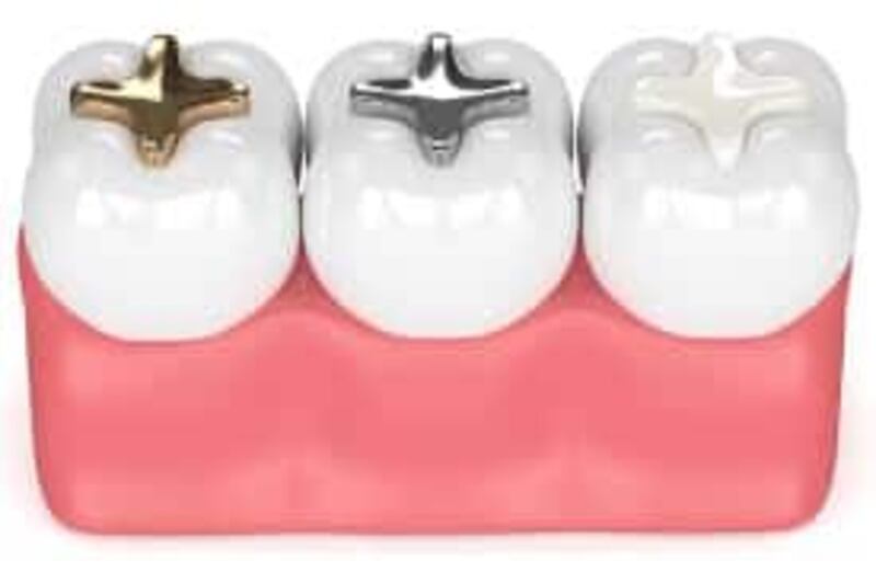 أوروبا تحظر حشوات الأسنان من الزئبق خلال عام