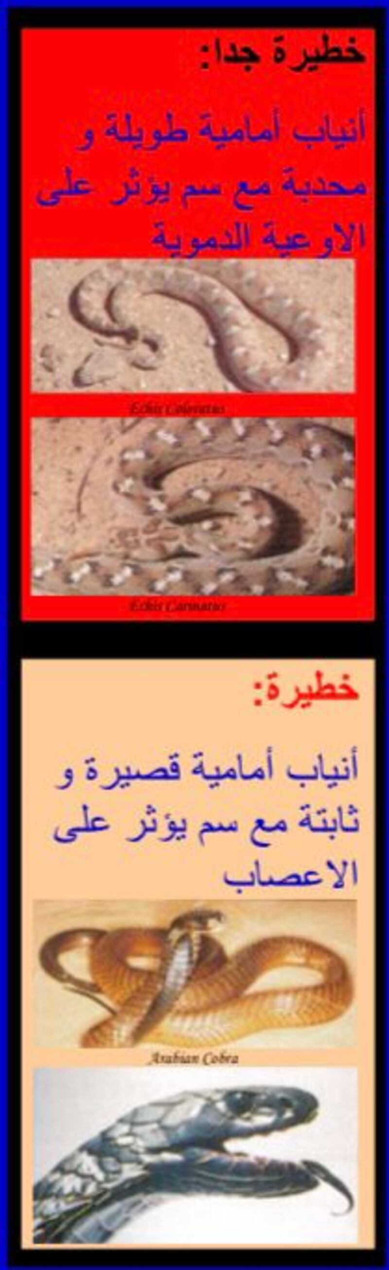 قد تتسبب في مضاعفات خطيرة: كيف تتعامل مع لدغات الأفاعي؟