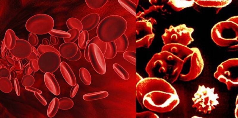 أخصائية تكشف عدد المصابين بالثلاسيميا في السلطنة…واختصاصية توضح أهمية الفحص قبل الزواج