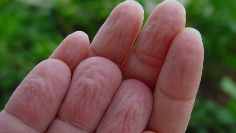 لماذا تتجعّد أصابعنا في الماء؟