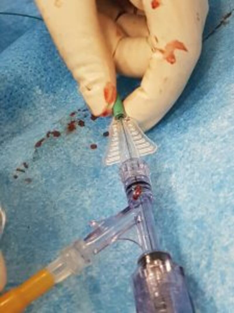 بالصور.. مستشفى خولة يقوم بإنجاز طبي فريد