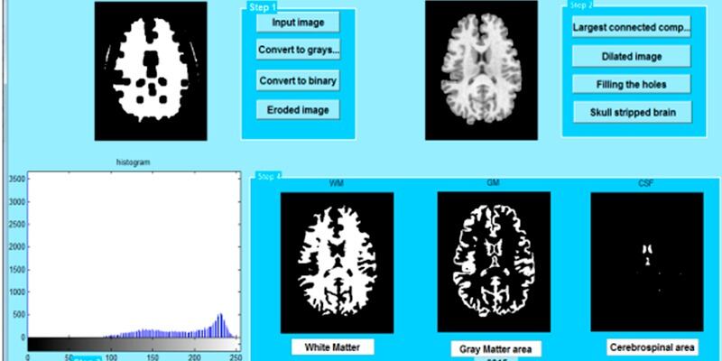 برنامج عماني ذكي يشخّص مرضى الزهايمر