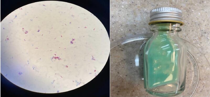 فريق طبي عُماني يكتشف حالة مرضية نادرة عالميًا