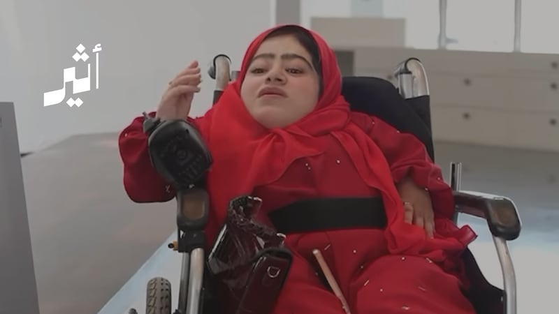 كيف تكمل دراستها الجامعية مع مرض العظم الزجاجي