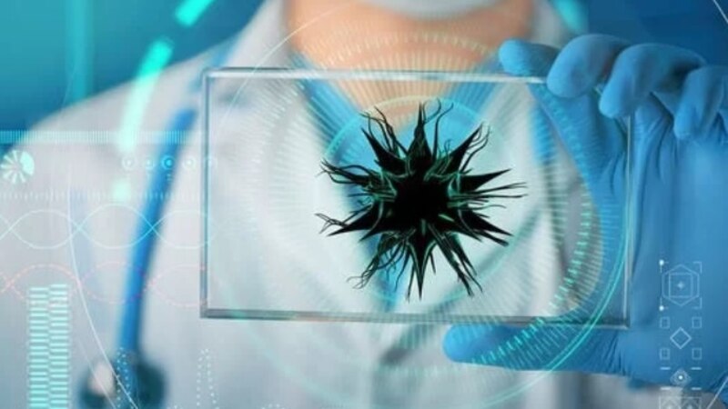 الصحة تؤكد على أهمية تأجيل السفر للدول الموبوءة، وتوضح أعراض فيروس ماربورغ