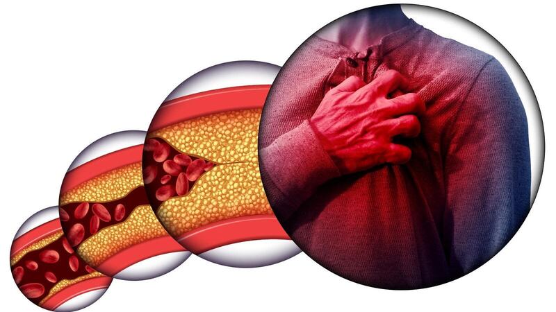 متخصص يوضح طرق وقاية الأطفال من الإصابة بارتفاع الكوليسترول