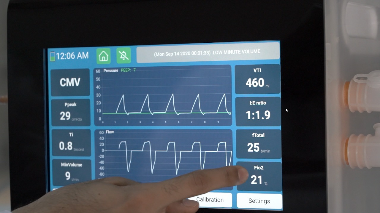 بالصور: شركة عُمانية تبتكر جهاز تنفس اصطناعيًا بميزة مُتفرِّدة
