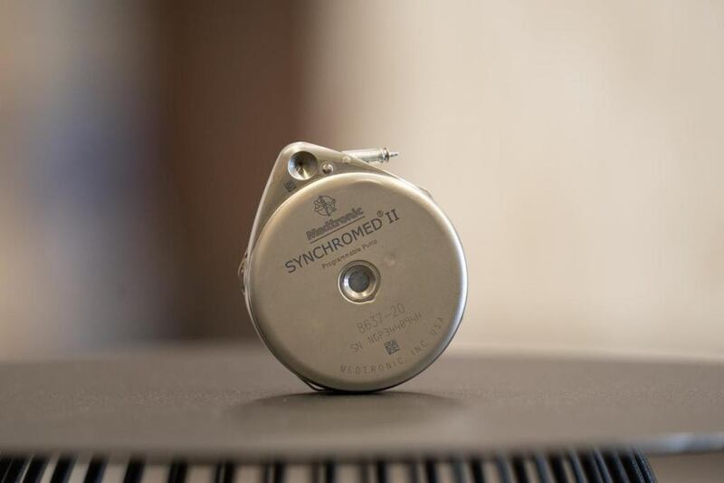 إجراء أول عملية زراعة مضخة مورفين لمريض عماني