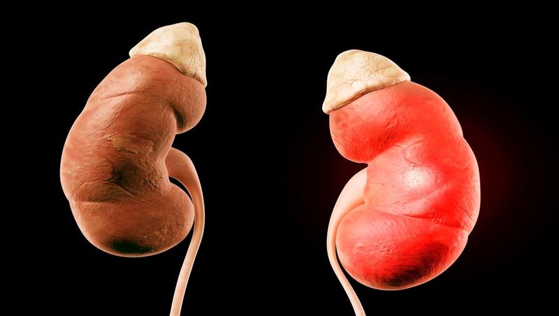 سفارتنا في باكستان تنبّه حول عمليات نقل الكلى