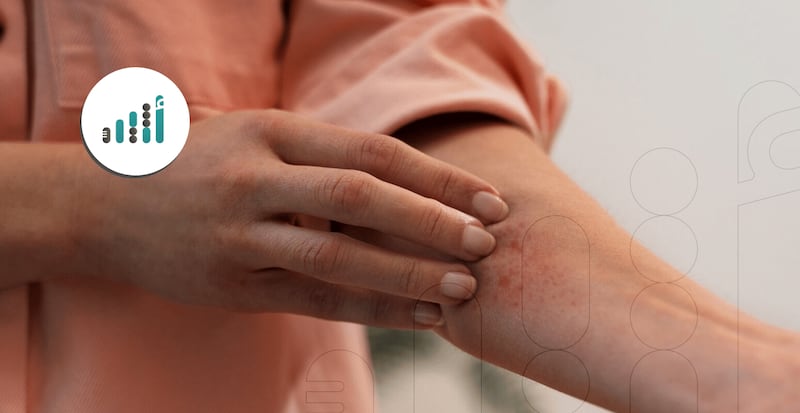 ماذا تعرف عن مرض الحزام الناري؟