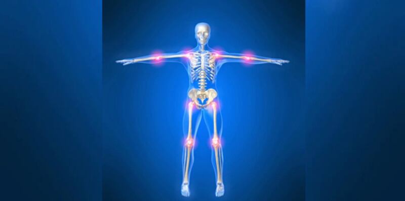 نتائج لدراسة حديثة تُبشِّر الذين يُعانون من التهاب المفاصل