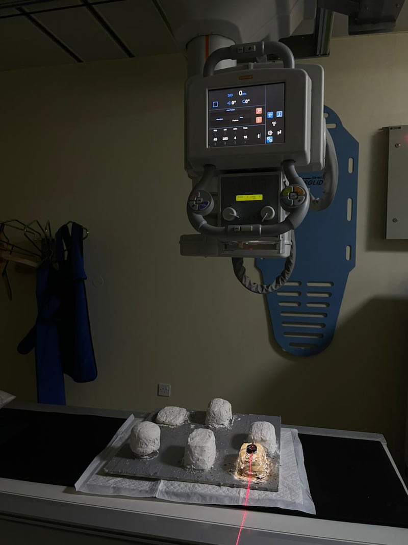 حصد عدة جوائز عالمية: عمانية تبتكر طلاء يمتص الأشعة السينية