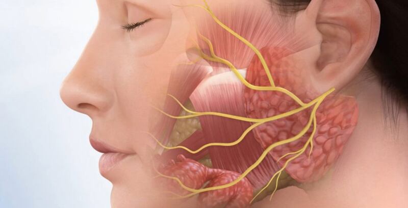 انتبه لهذه الأعراض؛ فقد تكون علامة على شلل العصب الوجهي