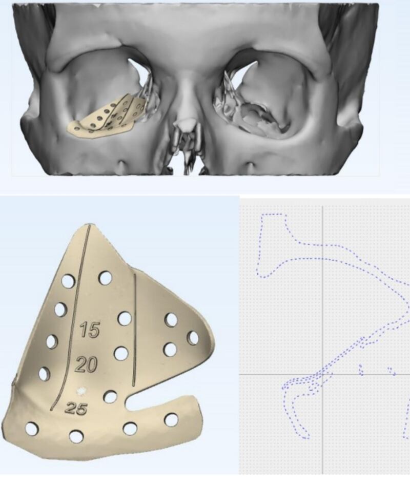 إجراء أول عملية من نوعها في سلطنة عمان