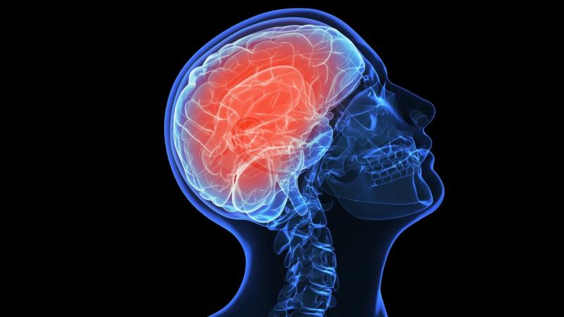 إجراء أول عملية إشعاعية للعصب الدماغي في سلطنة عمان