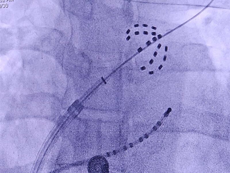 ما التقنية العالمية التي دشّنها المستشفى السلطاني مؤخرًا؟