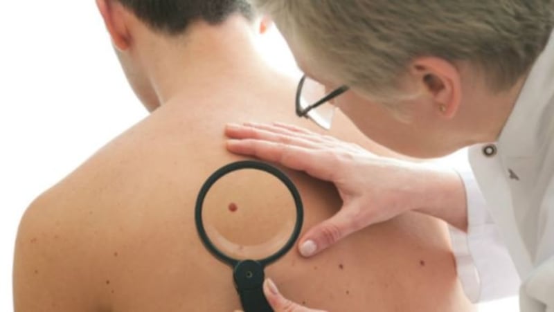 دراسة جديدة تحذّر: مكمل غذائي يزيد من الإصابة بسرطان الجلد