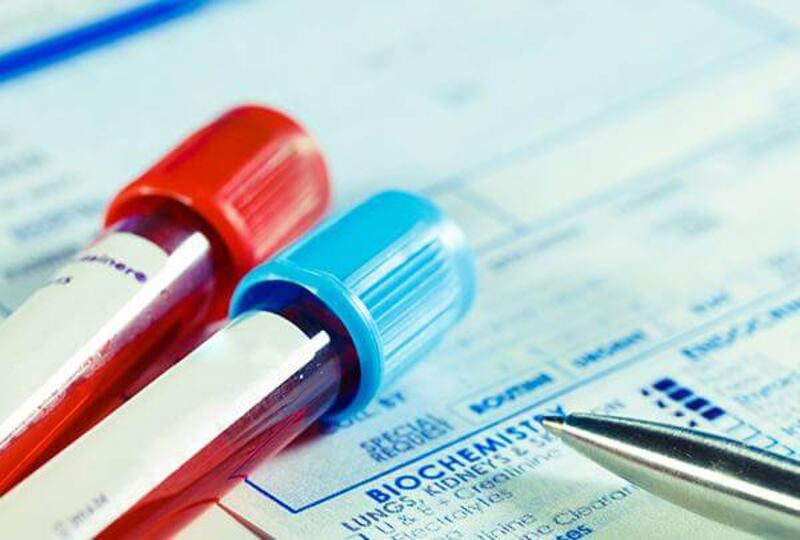 فتاة أجرته 3 مرات: دكتور يوضح أهمية الفحص قبل الزواج ويسرد قصصًا واقعية