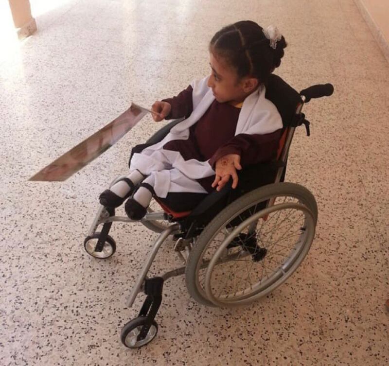 بالصور: آية الجديدية وُلدت بمرض “العظم الزجاجي” وتحلم بالدراسة الجامعية