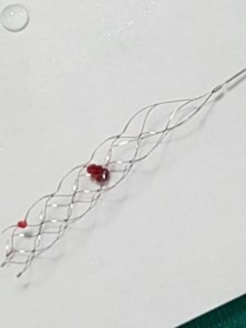 بالصور.. مستشفى خولة يقوم بإنجاز طبي فريد