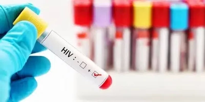 ارتفاع الإصابات بالإيدز وتقرير يكشف التفاصيل